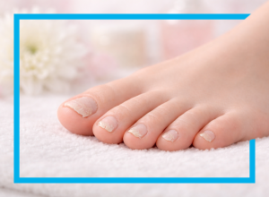 Foot with brittle nails